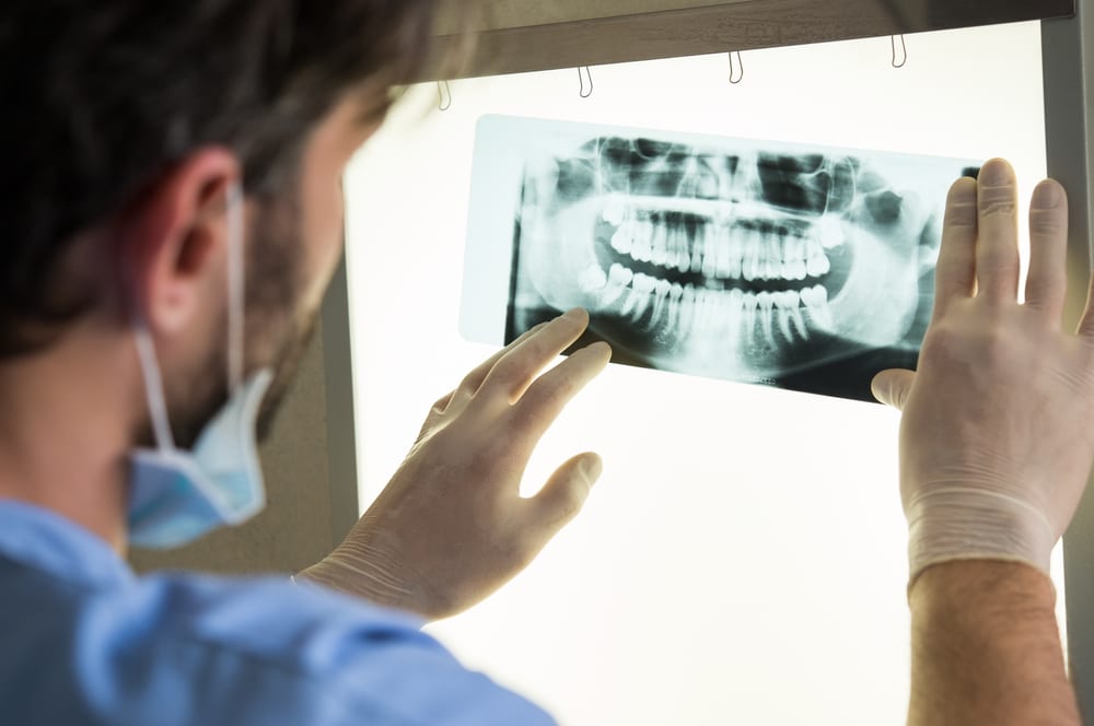 Are Dental XRays Safe? Dr. Rebecca Rath DMD Billings Dentist