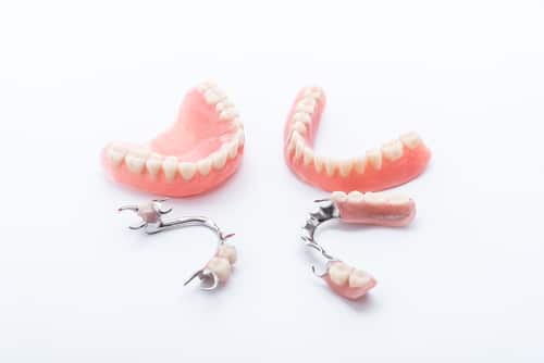 dentures versus implants